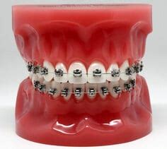 3m traditional metal bracket|3m orthodontic brackets.